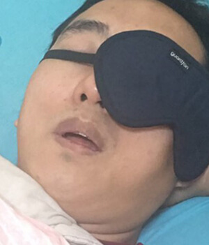 眼罩傷眼獨眼龍